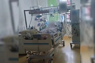 Пока мама спала в соседней комнате, трёхлетний малыш получил страшные травмы: состояние ребёнка крайне тяжелое