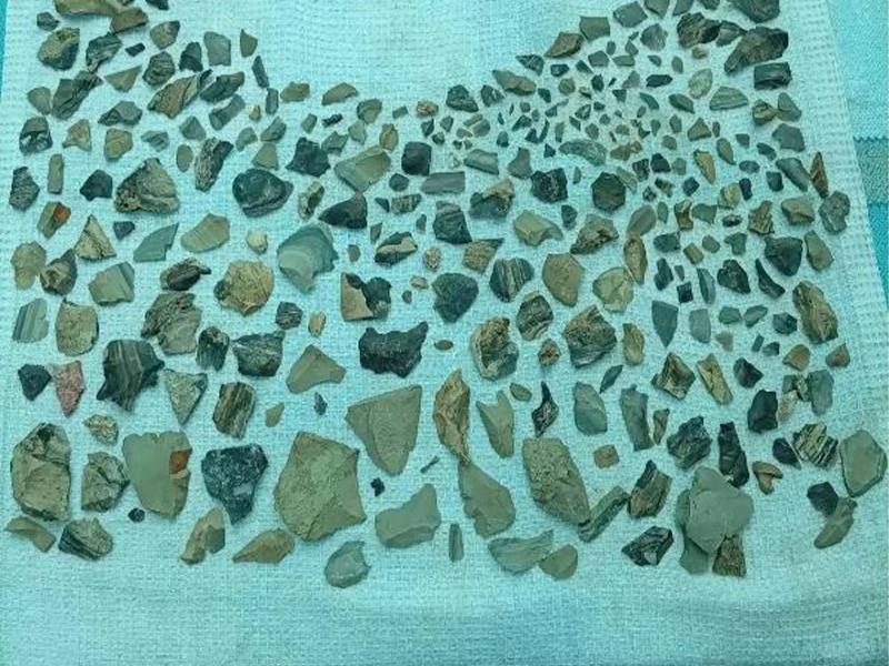 Археологи нашли 15 древних очагов в Усольском районе